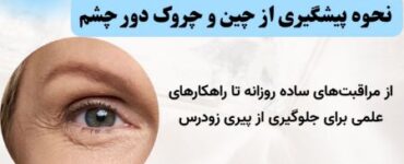راهنمای جامع پیشگیری از چین و چروک دور چشم