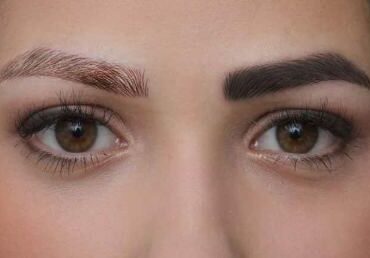 عوارض پاک کردن تاتو ابرو با لیزر {5 عوارض مهم و تجربی}