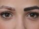 عوارض پاک کردن تاتو ابرو با لیزر {5 عوارض مهم و تجربی}