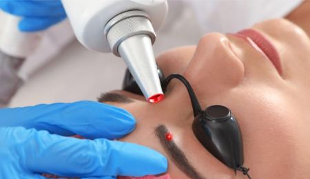 عوارض تاتو ابرو با دستگاه لیزر