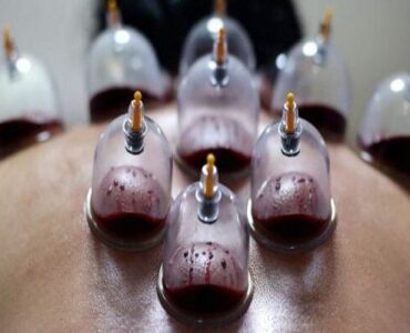 حجامت توسط افراد غیر متخصص خطرناک است