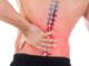 دیسک کمر را چگونه میتوان درمان کرد؟